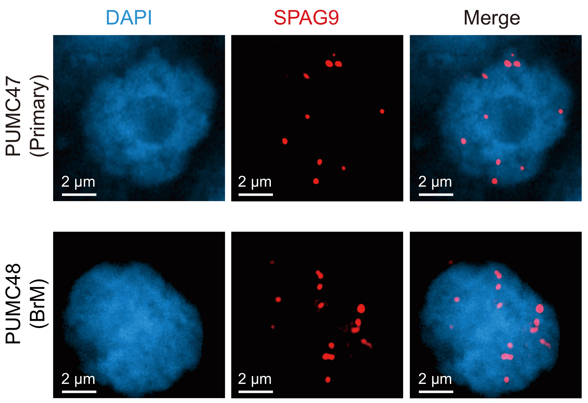 FISH staining validation image for ecDNA signals